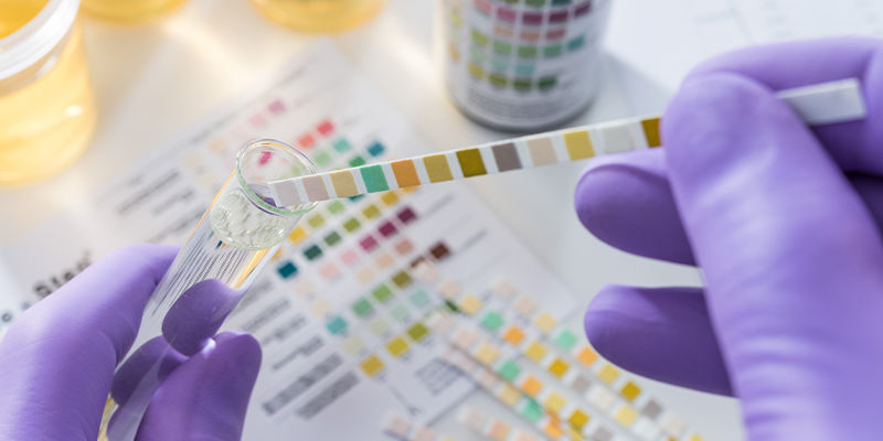 Le kratom sera-t-il détecté par un test de dépistage ?