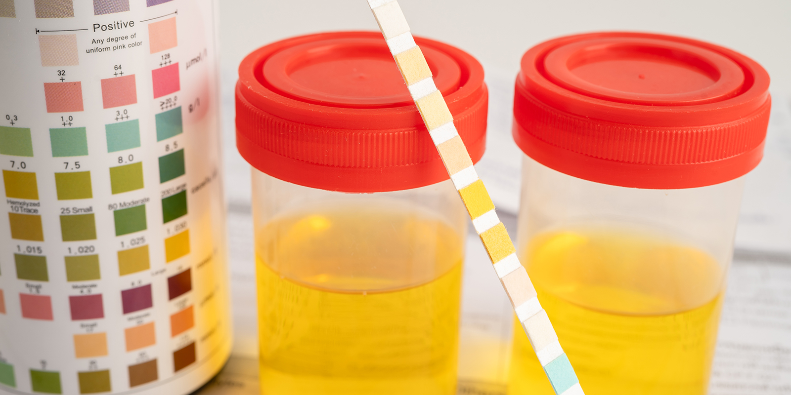 Fenêtres de détection