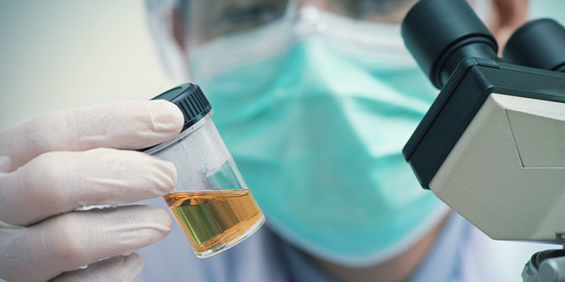 Exemples De Ce Qu’un Laboratoire Va Rechercher Dans Votre Échantillon D’urine