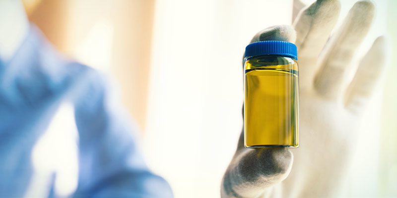 Que Se Passe-t-il Si Vous Échouez À Un Test De Dépistage De Drogues ?