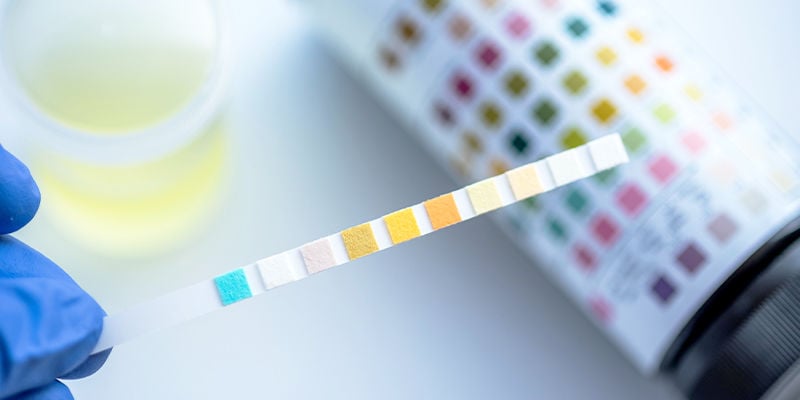 Comment fonctionnent les tests de dépistage du THC ?
