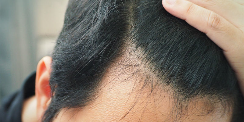 Cheveux, peau et ongles