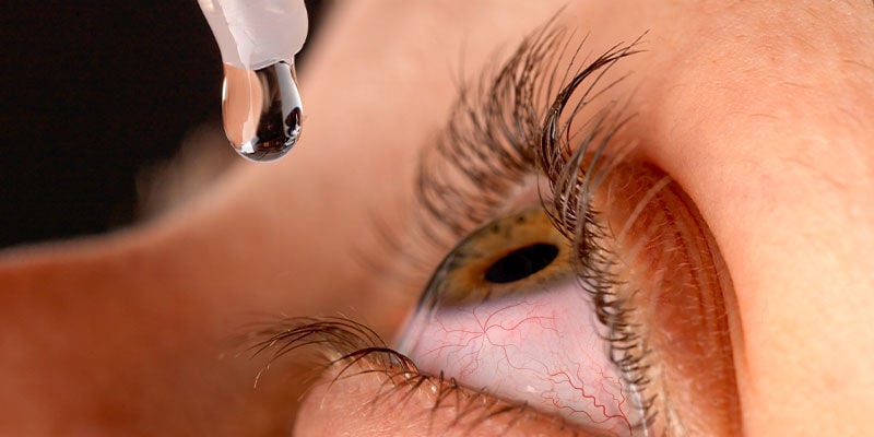Conseils pour se débarrasser des yeux rouges liés au cannabis