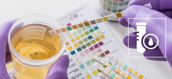 Comment Passer Un Test De Dépistage Du THC (2025)